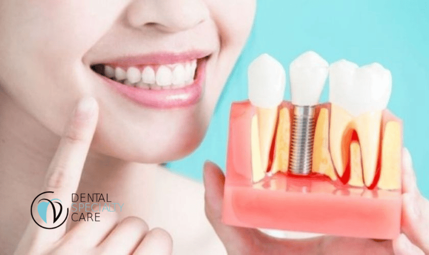 Dental Implants