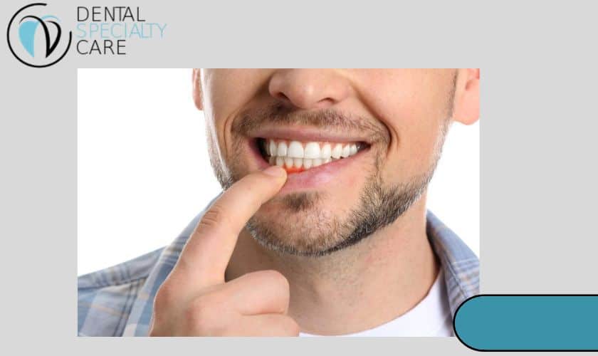 Periodontal-Disease