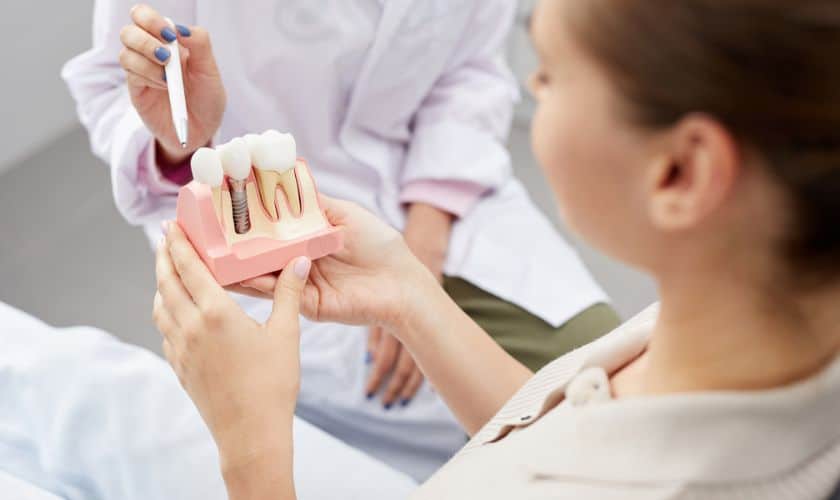 Dental-Implants