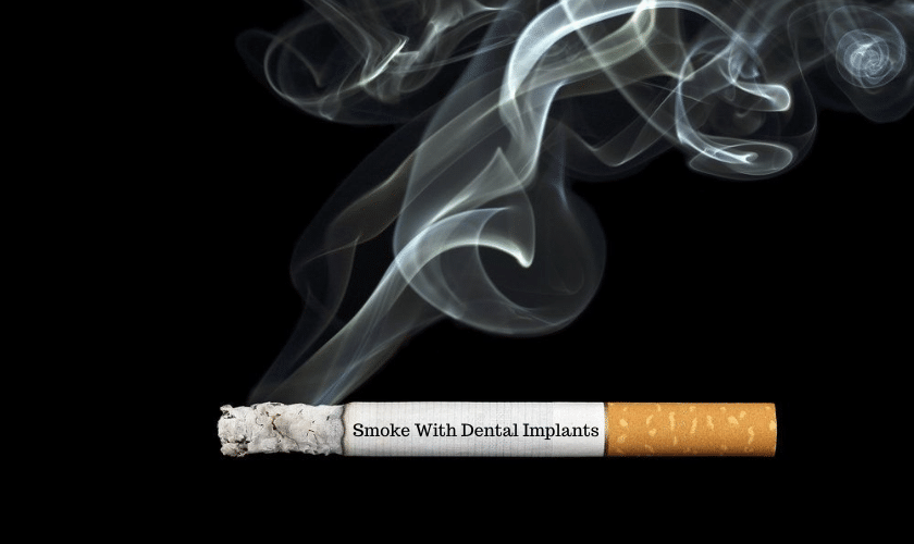 What Happens If You Smoke With Dental Implants