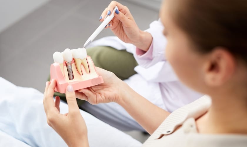 dental implants effect on facial appearance
