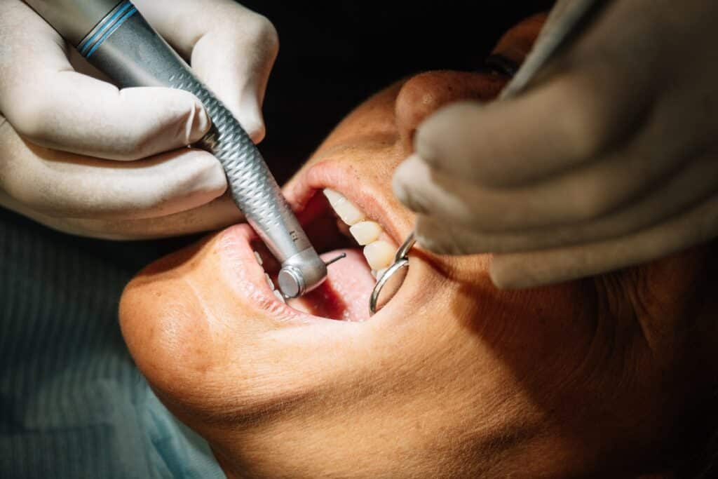 dental-implants-in-lancaster