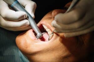 dental-implants-in-lancaster